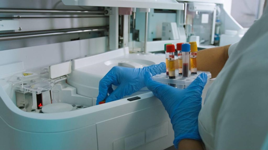Cortisol en tiempo real: el nuevo frontera de los sensores biomedicos